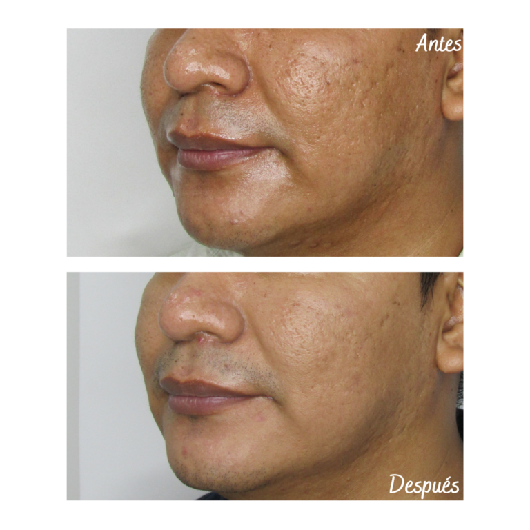 Tratamientos Estéticos - Dr. Óscar Gaona en Cali 1