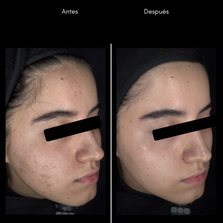 20230804_185644212_iOS