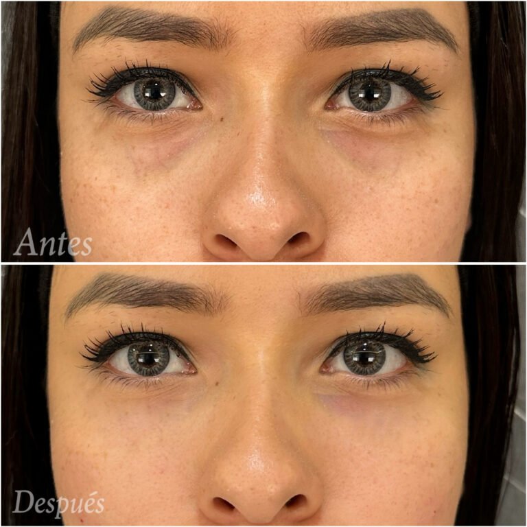 Tratamientos Estéticos - Dr. Óscar Gaona en Cali 11