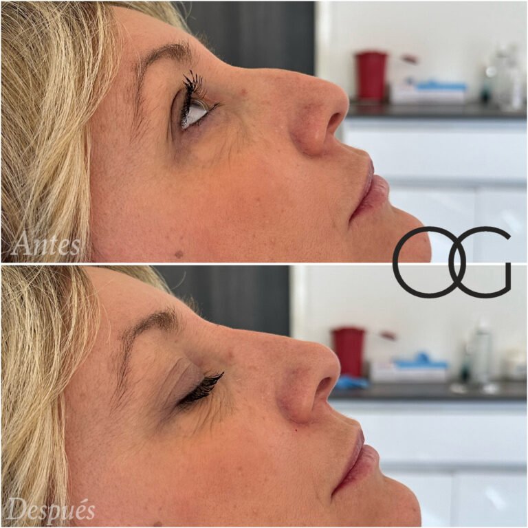 Tratamientos Estéticos - Dr. Óscar Gaona en Cali 18