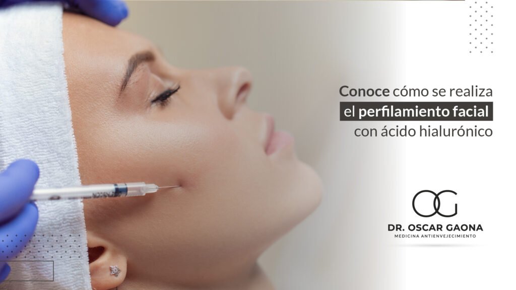 Perfilamiento facial con ácido hialurónico