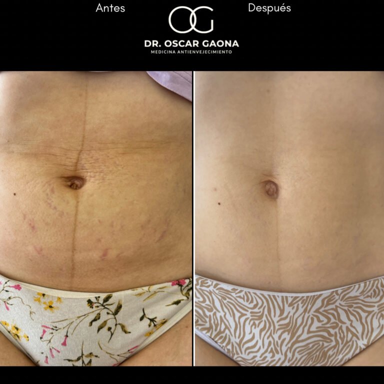 Tratamientos Estéticos - Dr. Óscar Gaona en Cali 2