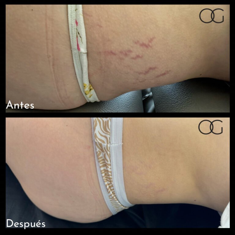 Tratamientos Estéticos - Dr. Óscar Gaona en Cali 3