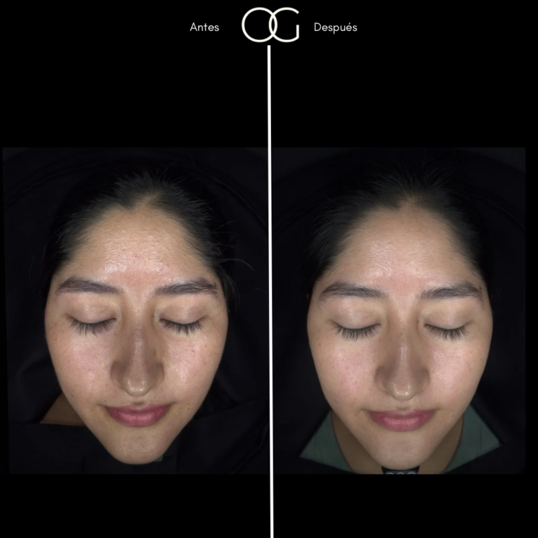 Tratamientos Estéticos - Dr. Óscar Gaona en Cali 19
