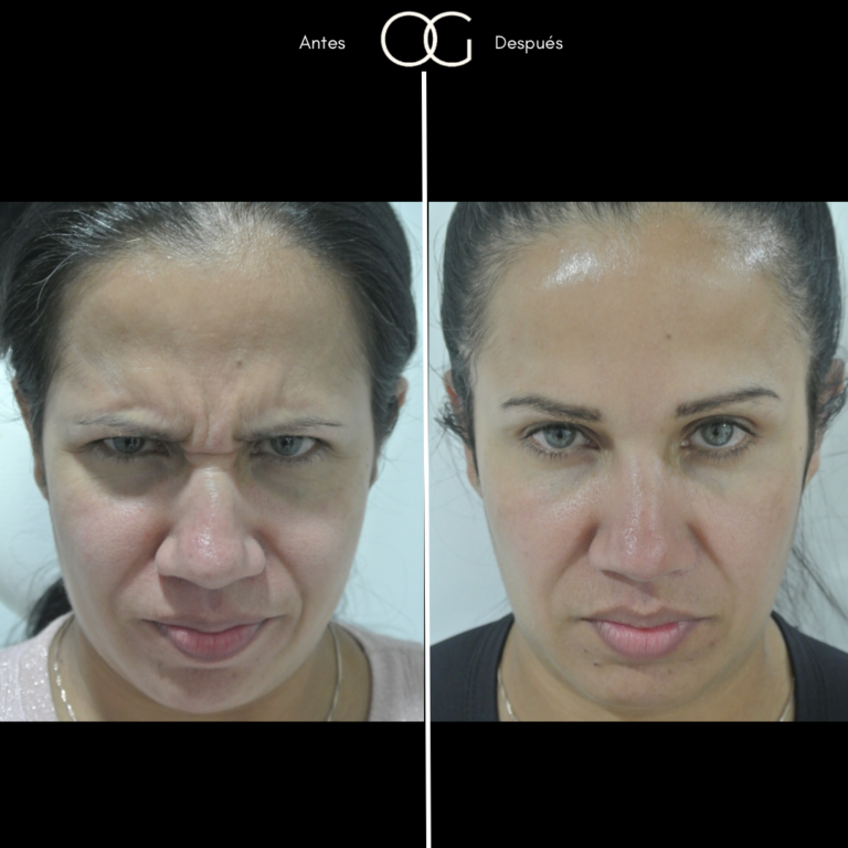 Tratamientos Estéticos - Dr. Óscar Gaona en Cali 8