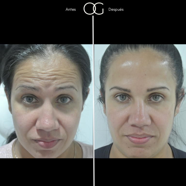 Tratamientos Estéticos - Dr. Óscar Gaona en Cali 9