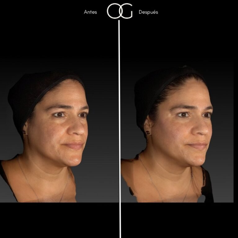 (copia conflictiva) ANTES 5