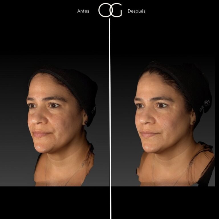 (copia conflictiva) ANTES 6