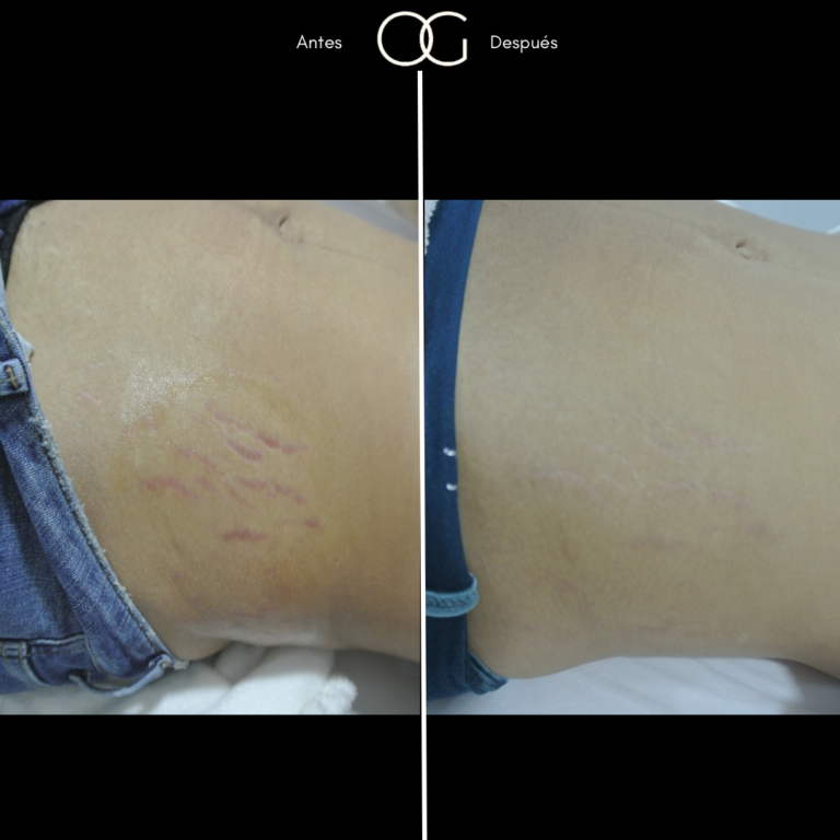 Tratamientos Estéticos - Dr. Óscar Gaona en Cali 4